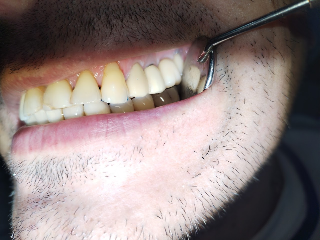 Atención odontológica en el consultorio